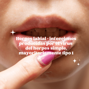 Herpes labial